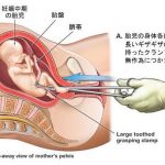 レス17番の画像サムネイル