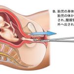 レス17番の画像サムネイル