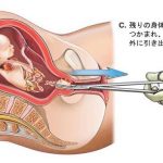 レス17番の画像サムネイル