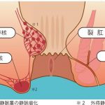 レス17番の画像サムネイル