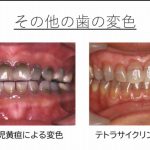 レス2番のサムネイル画像