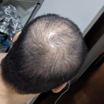 レス1番のサムネイル画像