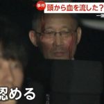 レス1番のサムネイル画像